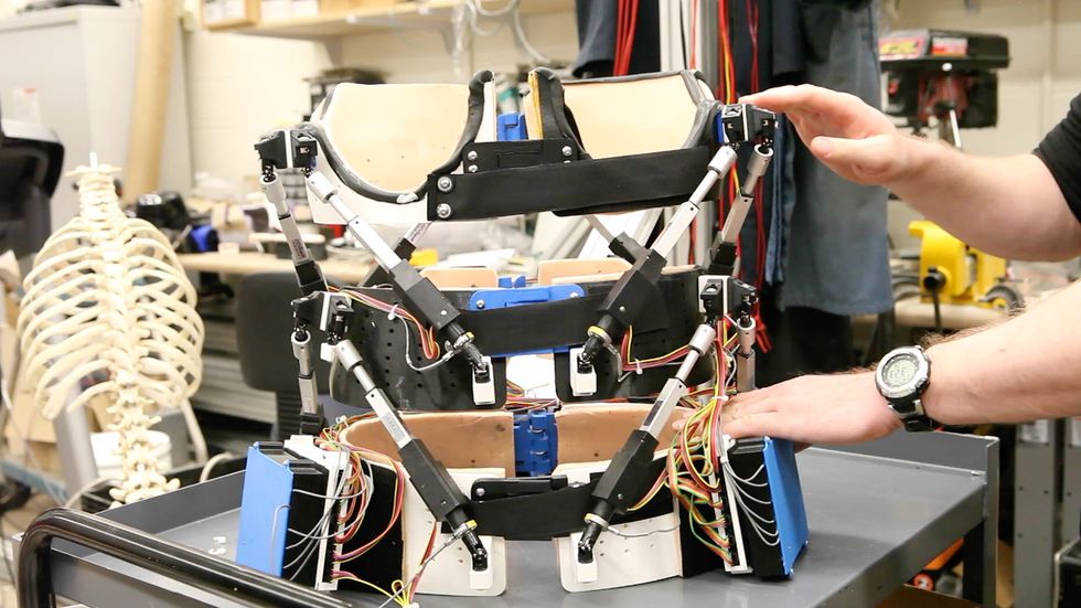 An Exoskeleton Spine Brace for Scoliosis