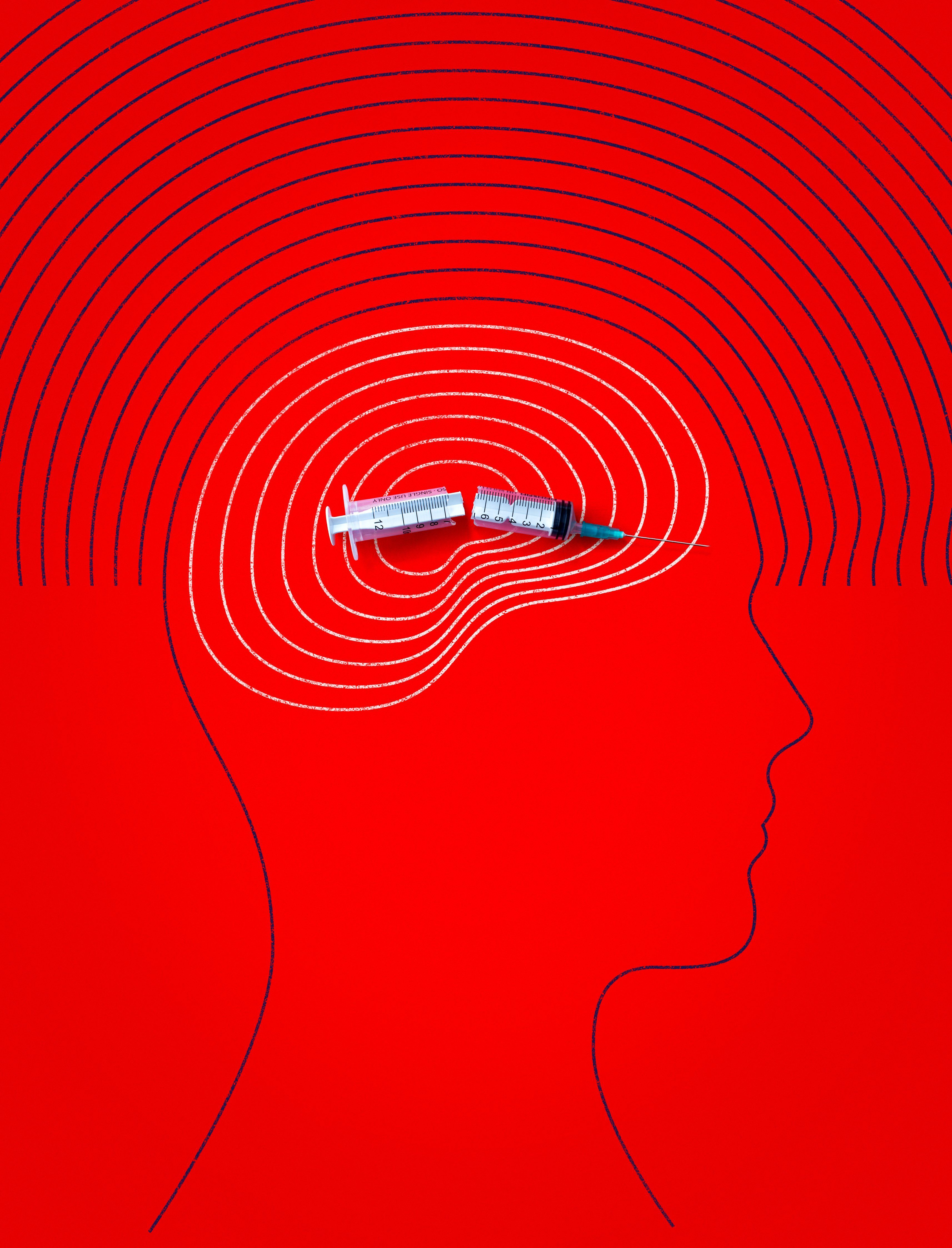 An illustration of person's head with a broken hypodermic needle.   