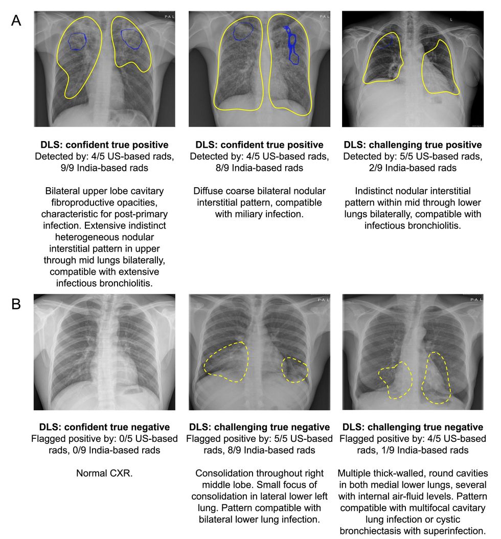 images of various chest x-rays