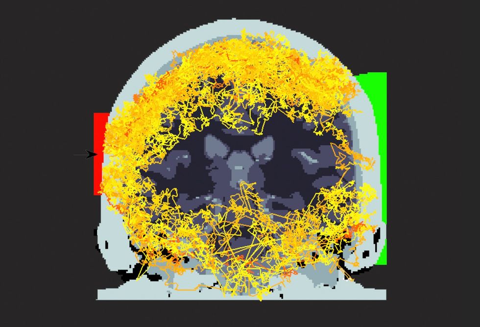 Imaging of a brain with a multitude of yellow squiggly lines tracing a path around the entire circumference of the image. On the left, a red square with an arrow faces the brain, and on the right there is a green square on the outside of the brain.