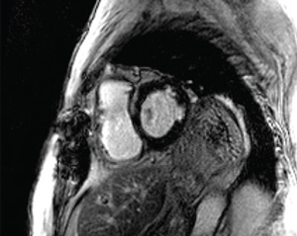 img - take MRI scans of the patient's heart