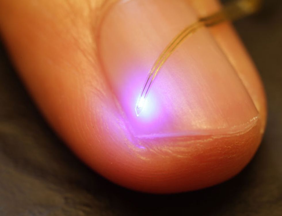 Implantable Optoelectronics: A flexible system that includes electrodes, LEDs, photodetectors, and a temperature sensor were designed to be implanted in an animal\u2019s brain and wirelessly controlled via an RF receiver affixed to the animal\u2019s skull.