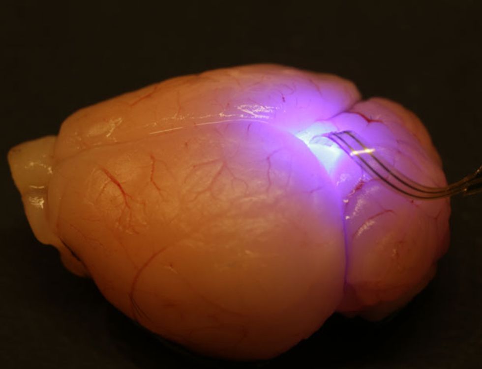 Implantable Optoelectronics: A flexible system that includes electrodes, LEDs, photodetectors, and a temperature sensor were designed to be implanted in an animal\u2019s brain and wirelessly controlled via an RF receiver affixed to the animal\u2019s skull.
