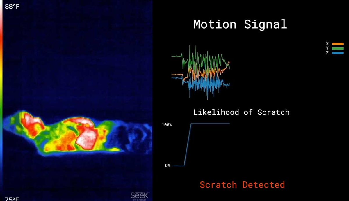 Infrared camera footage shows a child scratching while wearing an ADAM sensor. The outputs of the sensors are shown as the child scratches.