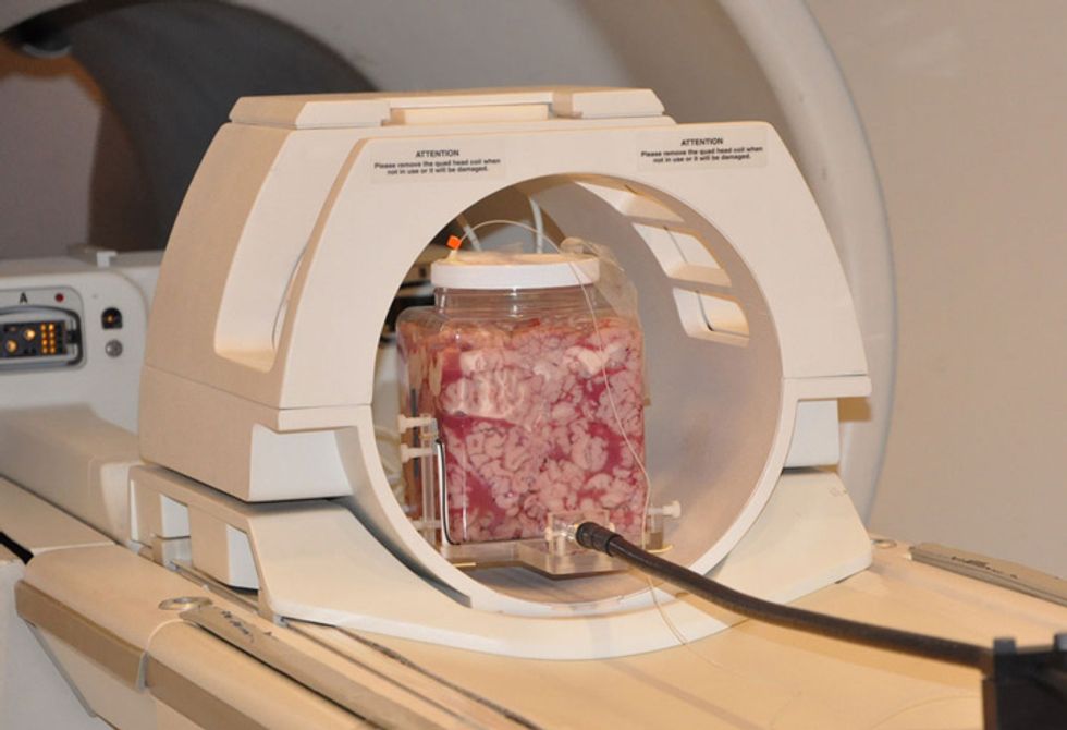 jarred cow brains to test whether MRI scans can map the heat generated by cellphone radiation