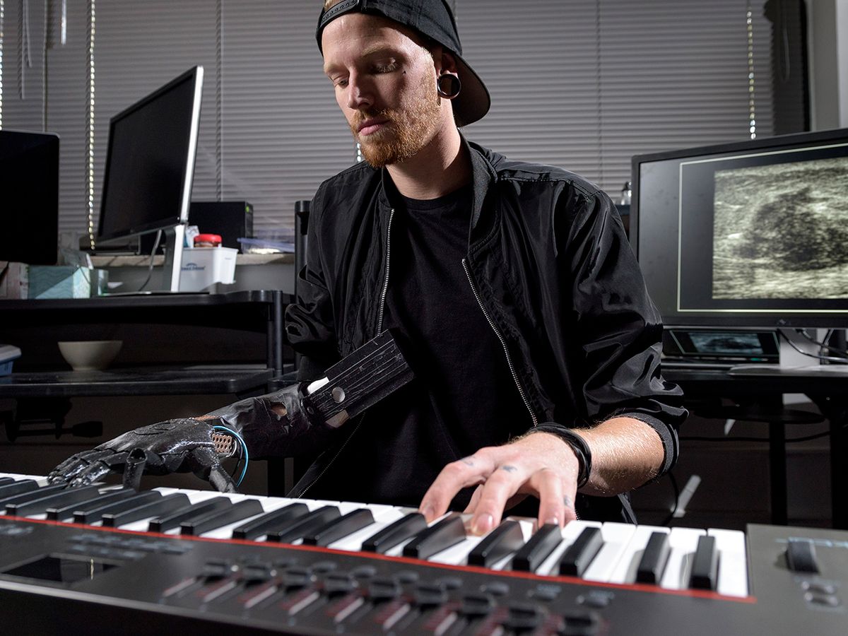 Jason Barnes lost part of his right arm in 2012. He can now play the piano by controlling each of his prosthetic fingers.