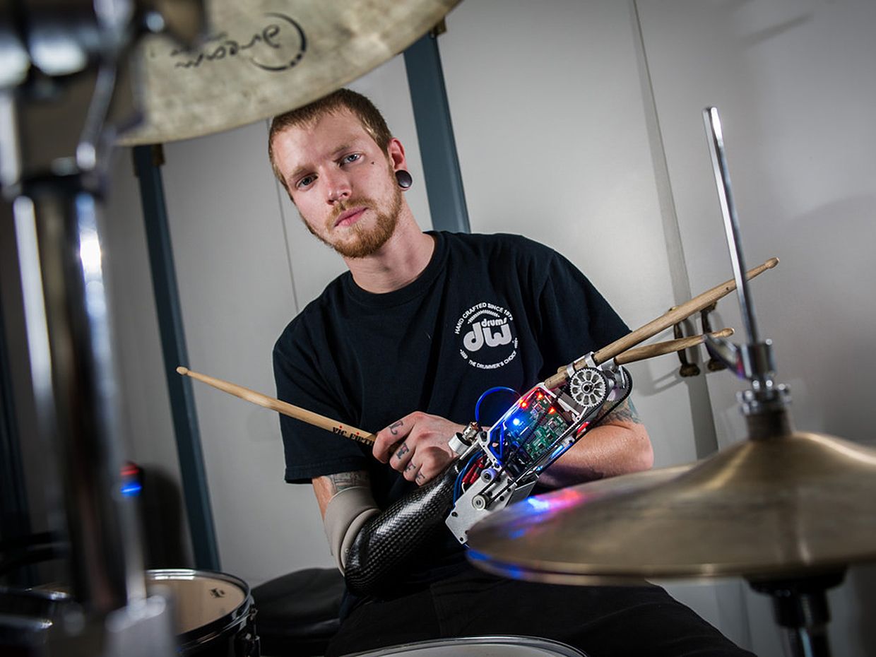 Jason Barnes with the robotic drumming prosthesis.