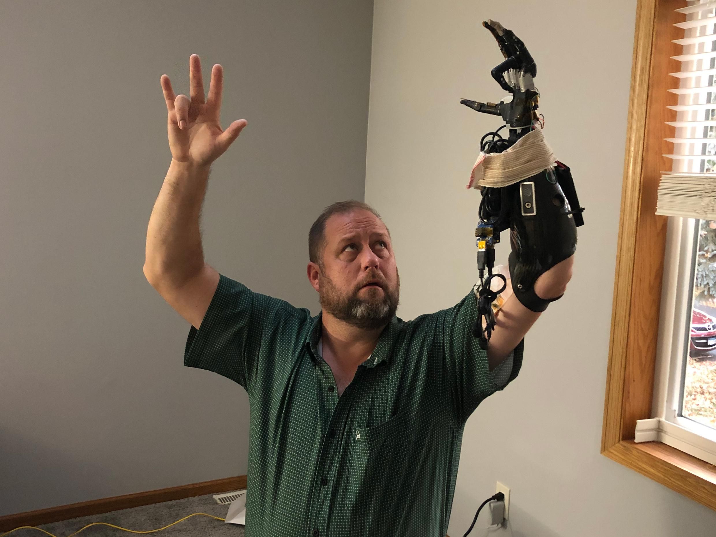 https://spectrum.ieee.org/media-library/less-than-p-greater-than-a-study-participant-controls-his-prosthetic-hand-with-a-new-peripheral-nerve-interface-whereby-he-simply-thinks-about-moving-individual-fingers-on-his-prosthetic-hand-and-it-does-the-corresponding-movement-less-than-p-greater-than.jpg?id=29640140