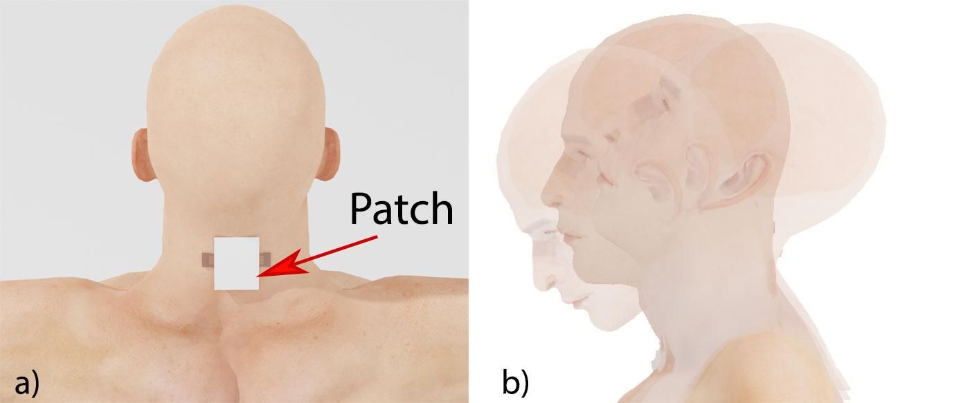 image of back of man's head and shoulders with a patch taped to his lower neck; right image is a time lapse image of a man's head extending far forward and back, simulating a case of whiplash