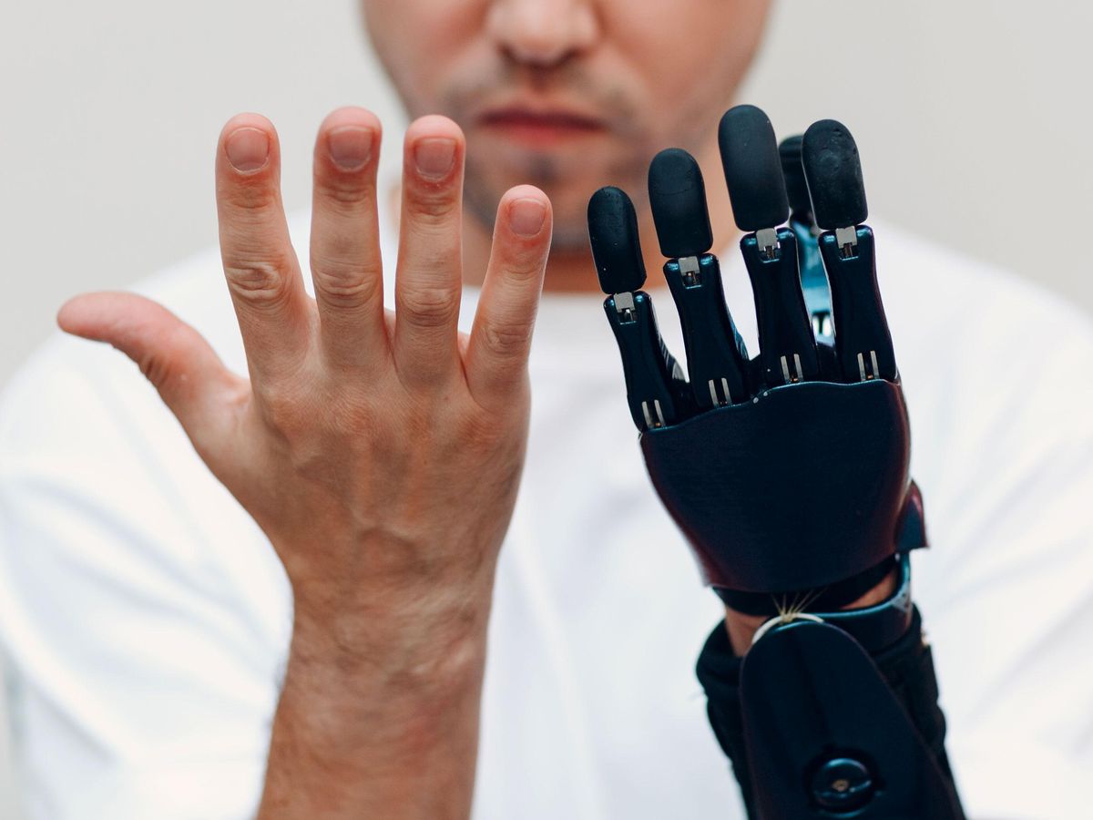 man holding up hands, one with bionic hand