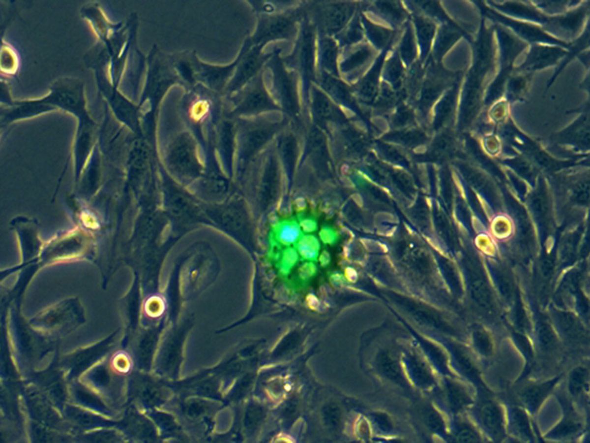 Microrobot carrying mesenchymal stem cells (fluorescent green) on a cell culture plate.
