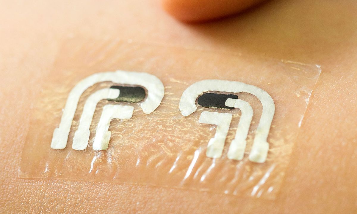 Nanoengineers at the University of California, San Diego have tested a temporary tattoo that both extracts and measures the level of glucose in the fluid in between skin cells.