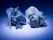 3-D Printing Software Turns Heart Scans into Surgical Models
