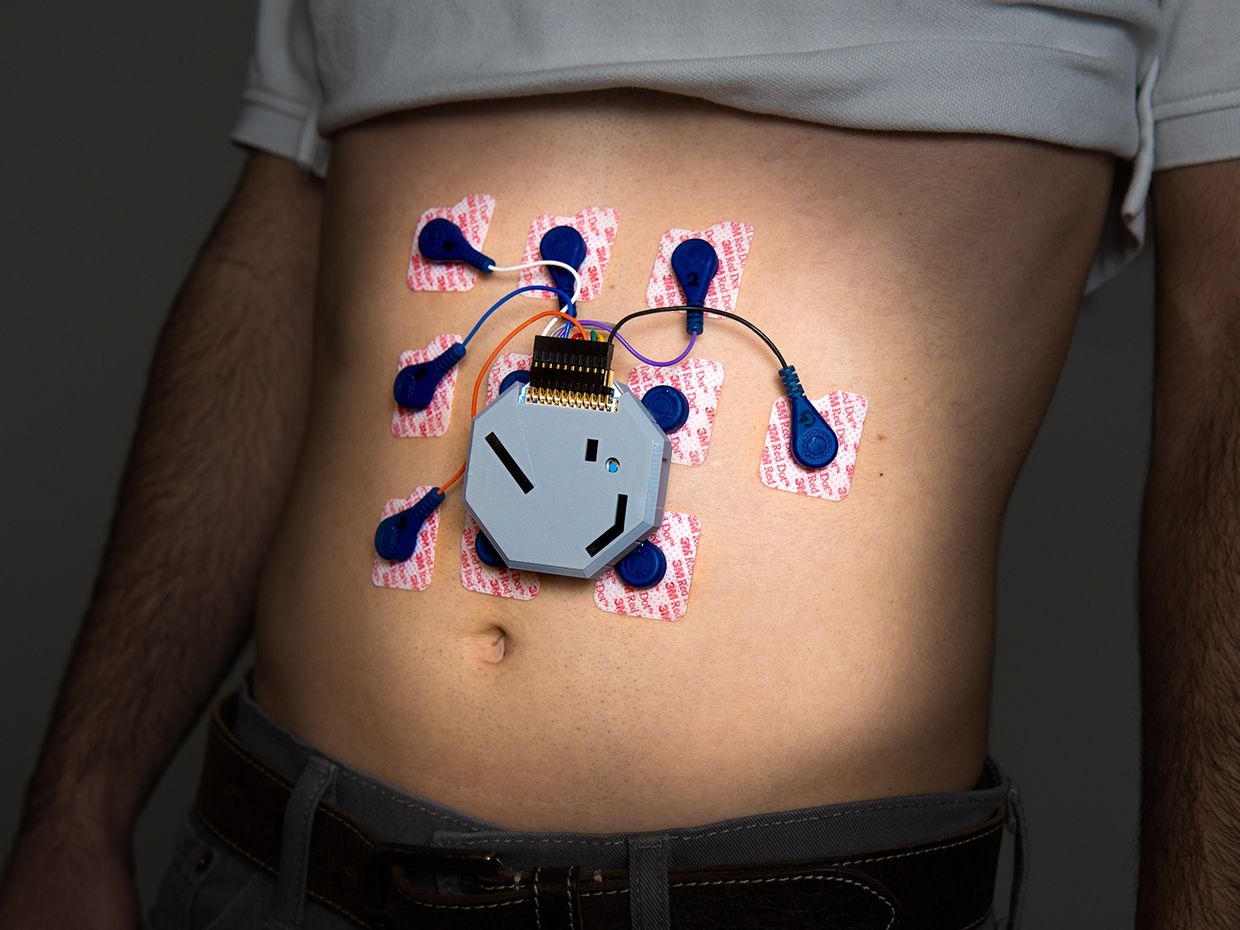 Person wearing a Coleman stomach system