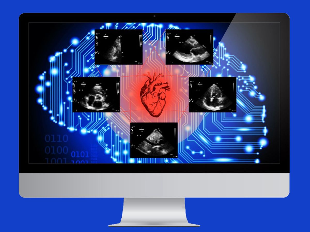 Photo-illustration of an AI computer analyzing heart scans.