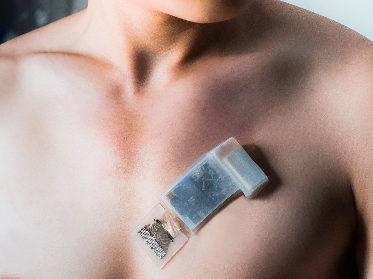photo of a person's upper torso, on their skin is a device beneath which is an electrode with many wires attached 