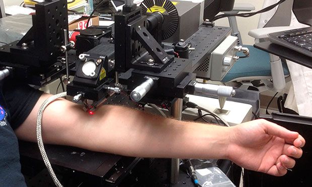 Photo of laser beaming into an arm.