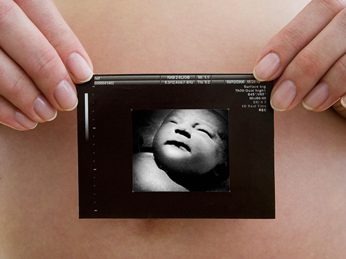 Photo of woman's abdomen holding ultrasound image.