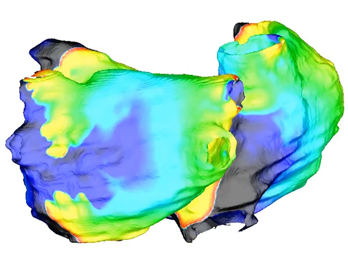 Researchers simulate irregular heartbeats to find exactly where they emerge from