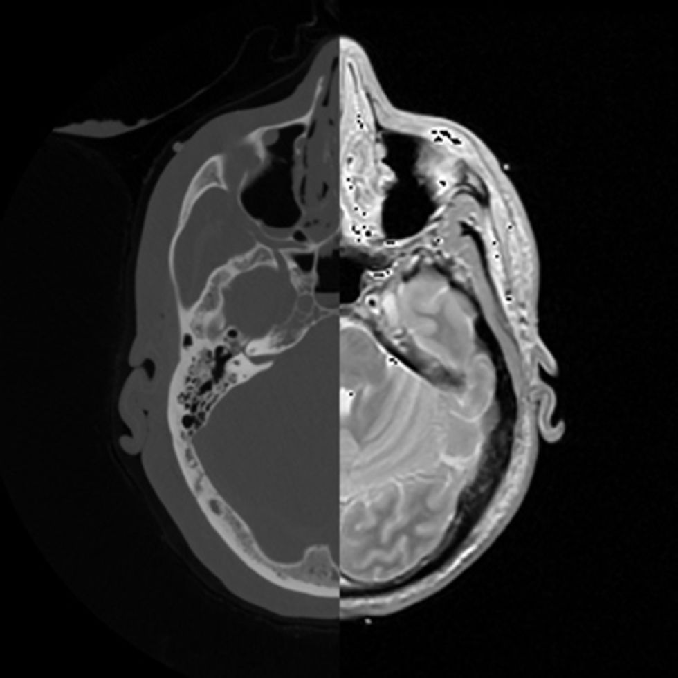 Seeing Both Sides: A CT scanner\u2019s X-rays (left side) provide good structural detail; MRI images (right) are good for seeing functional flaws. Omni-tomography could combine the two technologies in the same machine.