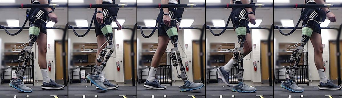 Series of 5 images showing a patient with a robotic prosthetic knee walking during the experiments.