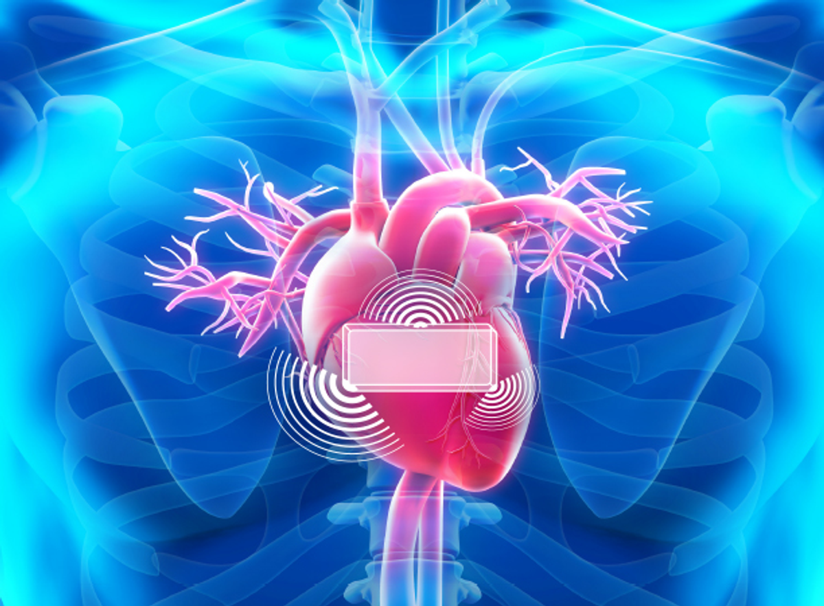 Small wearable heart device collects and transmits highly accurate heartbeat measurements