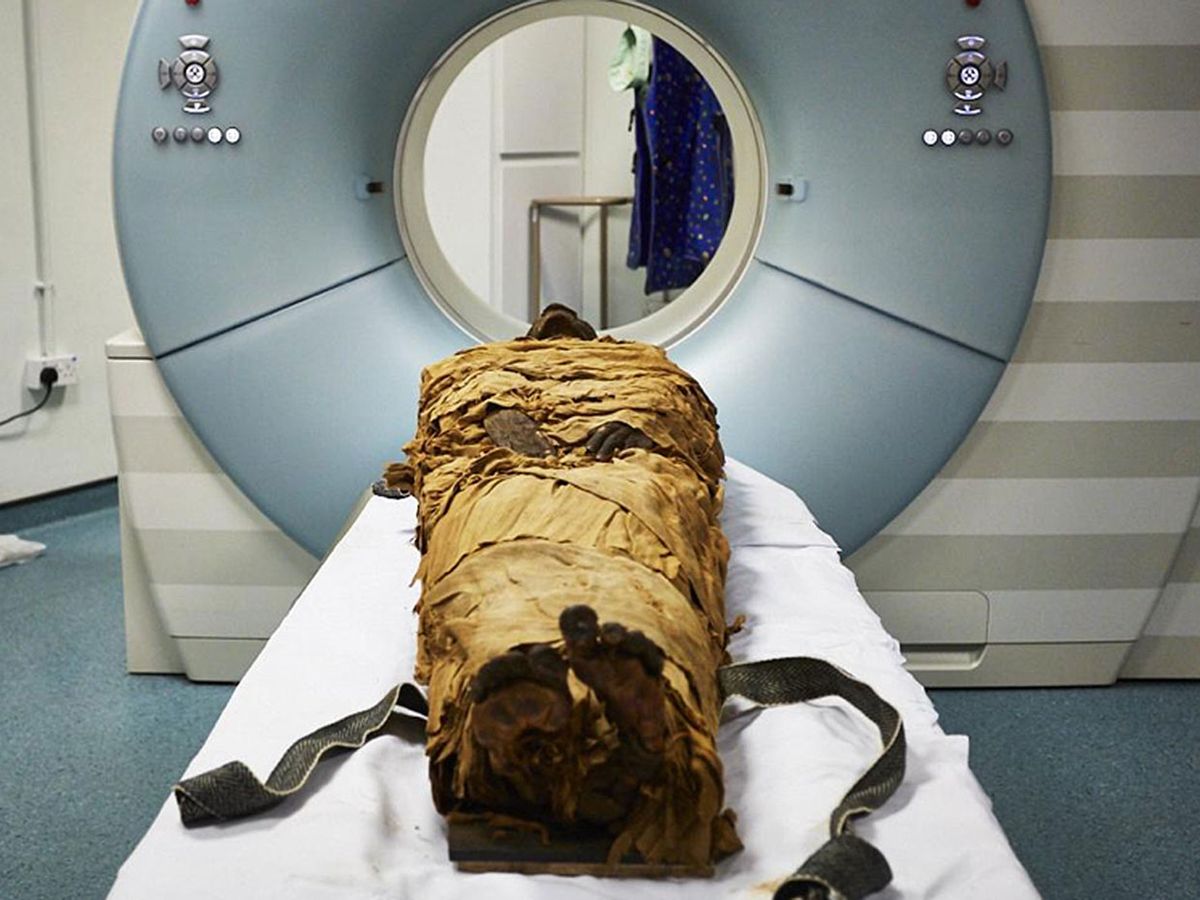 The mummified body of Nesyamun about to be CT scanned at Leeds General Infirmary