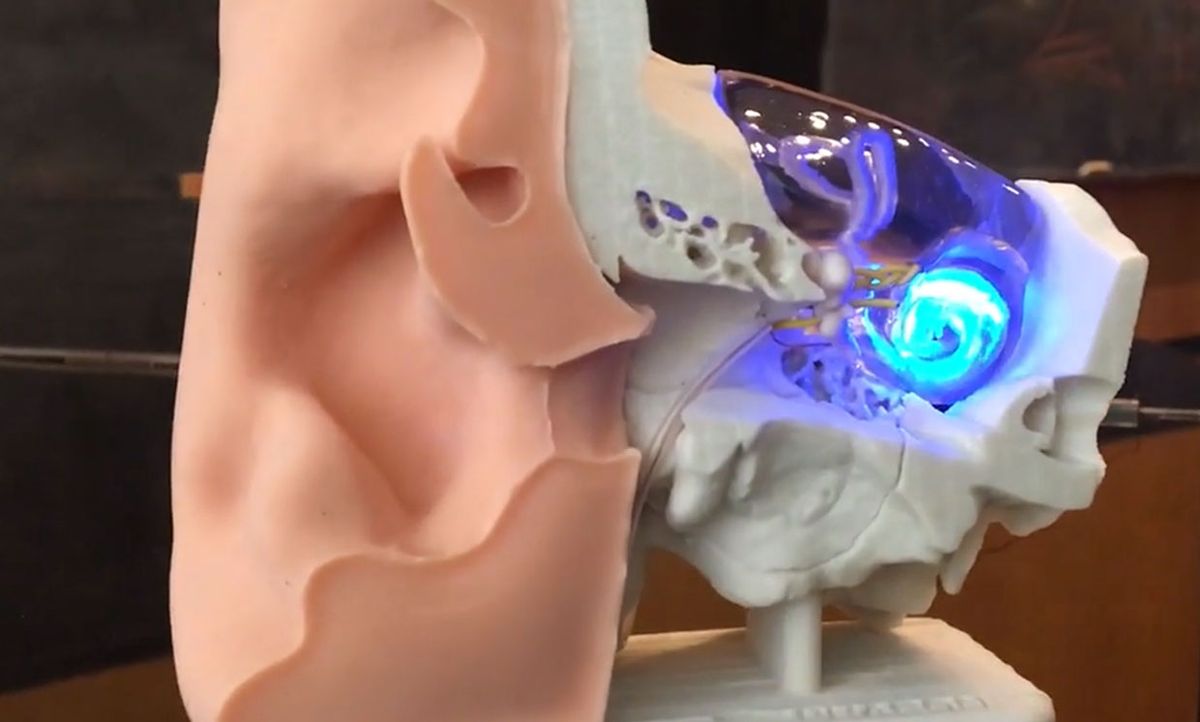 The optogenetic cochlear implant translates sound into optical stimulation patterns via LEDs placed within the cochlea.