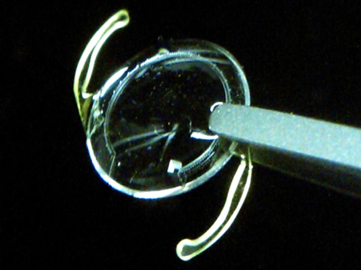 Tweezers holding a contact lens.