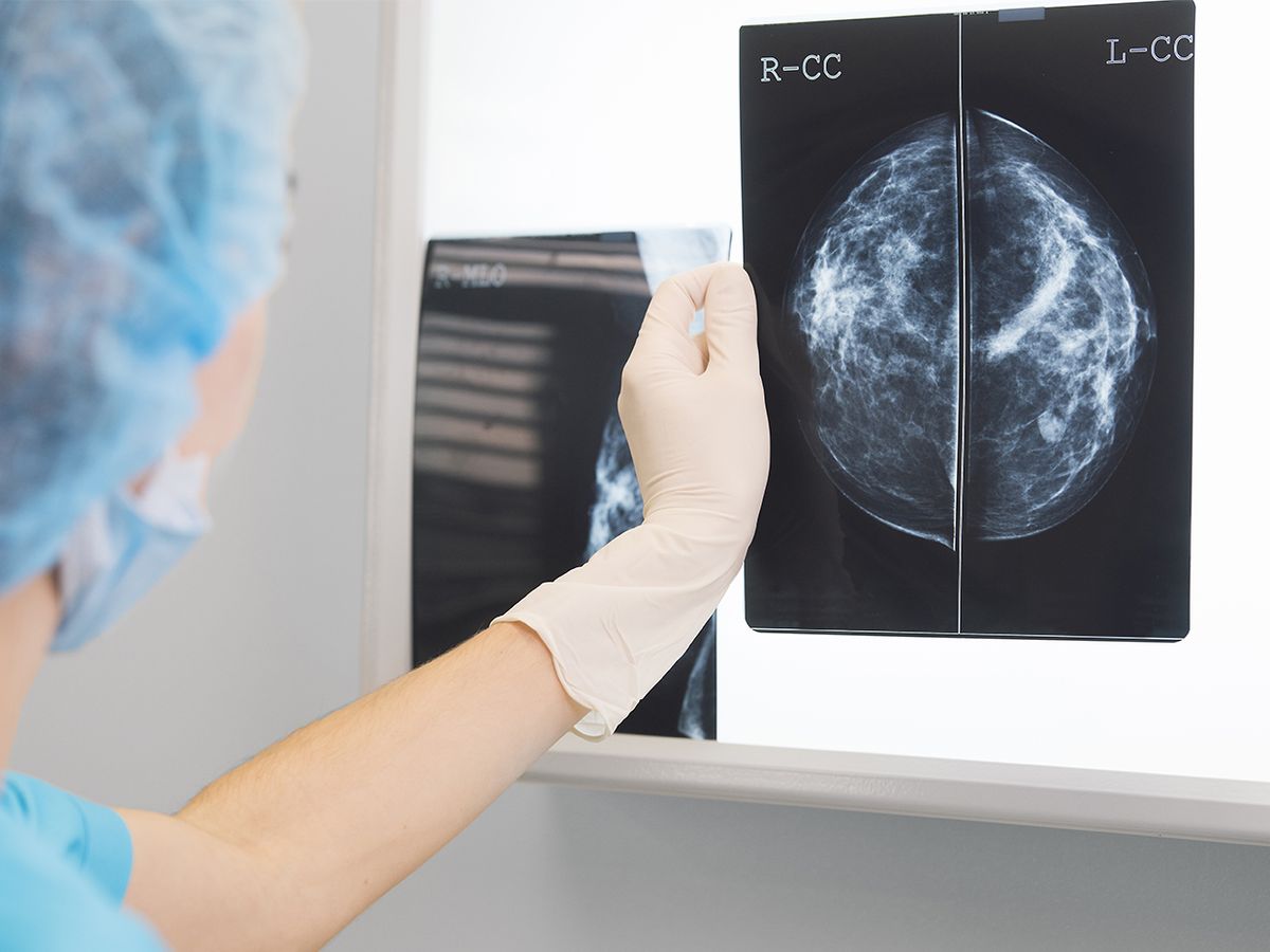 Woman doctor or nurse in surgery outfit is holding a mammogram in front of x-ray illuminator 